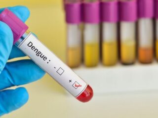 Dengue Test Costs