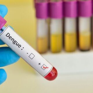 Dengue Test Costs