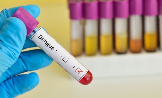 Dengue Test Costs